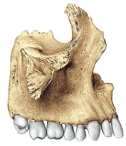 Maxilla Corpus Proc.