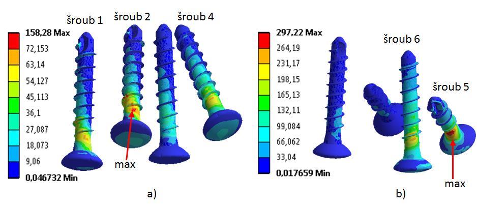 8.5 ANALÝZA NAPĚTÍ VE ŠROUBECH PAC 2 Spojení dlahy s kostními tkáněmi bylo provedeno osmi šrouby, které připevňují oba konce dlahy ke kostním tkáním.