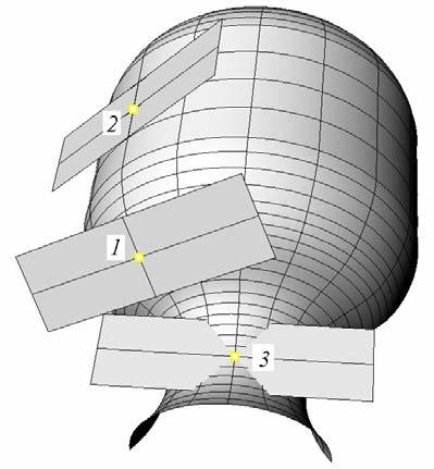 . Eliptický, parabolický a hyperbolický bod: Bod P plochy nazýáme a) eliptický b) parabolický c) hyperbolický práě tehdy, když existuje jeho okolí O ( P) tečná roina τ bodě P G ε tak, že a) tomto
