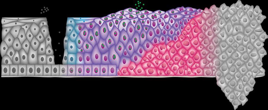 Je důležité zjistit obojí, rizika a progresi HPV HPV DNA Test* HPV E6/E7