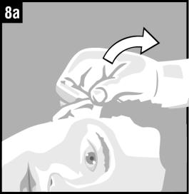 7. Vyprázdněte veškerý obsah jednoho jednodávkového obalu do ucha. 8a. U pacientů s infekcí zevního ucha jemně zatáhněte za boltec směrem nahoru a dozadu.
