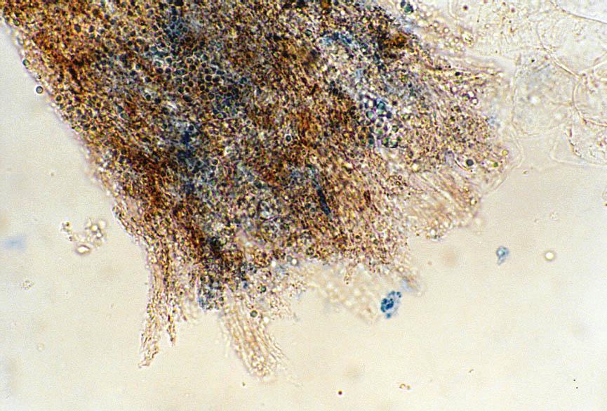 folikulu proniká houba na vnější