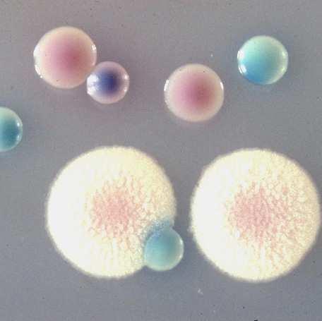 Obr. 1: Kvasinkové kolonie narostlé na CHROMagaru Zdroj: CHROMagar Microbiology. CHROMagar Candida [online]. c2009, [citováno 30.10.2010]. Dostupné z: http://www.chromagar.com/p- About_us.html?