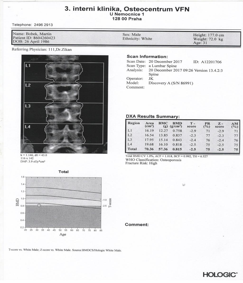 DXA Kostní denzita významně snížena