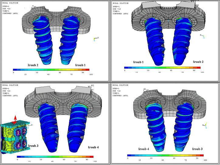 Věda a výzkum Řešení kontaktních ú loh pomocí MKP - biomechanika Ing.