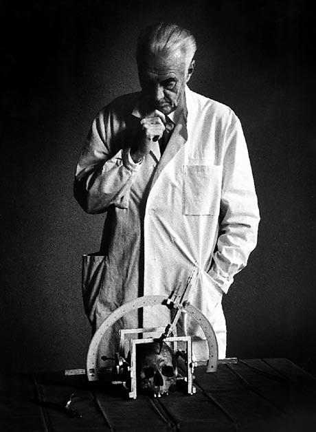 1 Historie radiochirurgie gama nožem V. Vladyka Obr. 1.1 Lars Leksell 1907 1986 (se svolením Elekta AB) Pojem radiochirurgie bývá nejčastěji spojován s Leksellovým gama nožem.