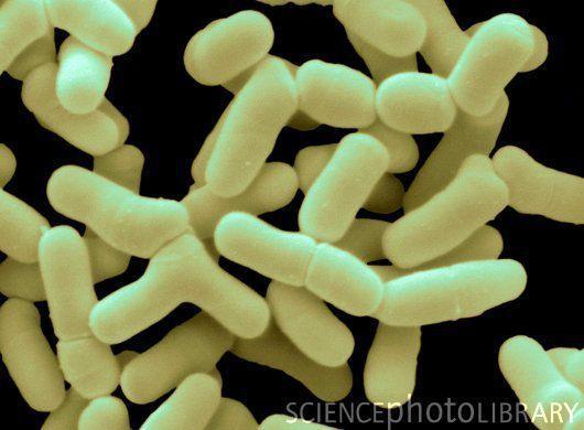 Obr.2: Bifidobacterium bifidum (www.sciencephotolibrary.com) 3.4.3 Rod Streptococcus Jsou to grampozitivní, nesporulující a striktně anaerobní mikroorganismy.