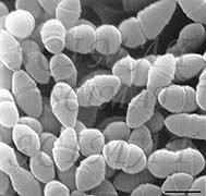 Obr. 3: Streptococcus salivarus spp. thermophilus (Kaláb, 2007) 3.4.4 Rod Enterococcus Enterokoky jsou grampozitivní, striktně anaerobní koky, které tvoří krátké řetízky.