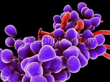 Obr. 4: Enterococcus faecalis (www.sciencephotolibrary.com) 3.4.5 Rod Lactococcus Tento rod zahrnuje grampozitivní, striktně anaerobní koky, které patří mezi homofermentativní bakterie mléčného kvašení.