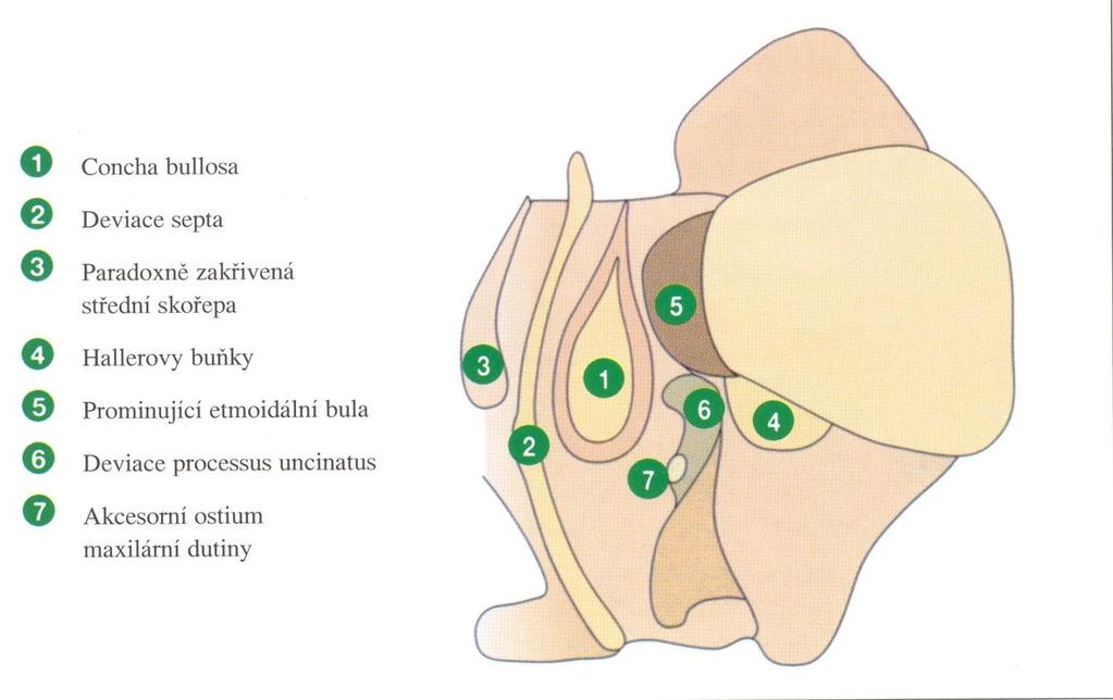 Anatomické varianty způsobující