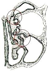 Functional endonasal sinus surgery (FESS) Základní postuláty Patologicky