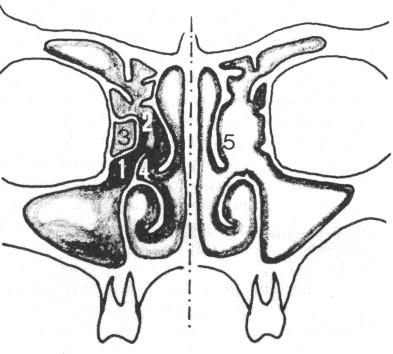 Patogeneze chronické rinosinusitidy circulus