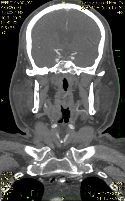 angiografie, 7,35 hod. (1h 45 min.