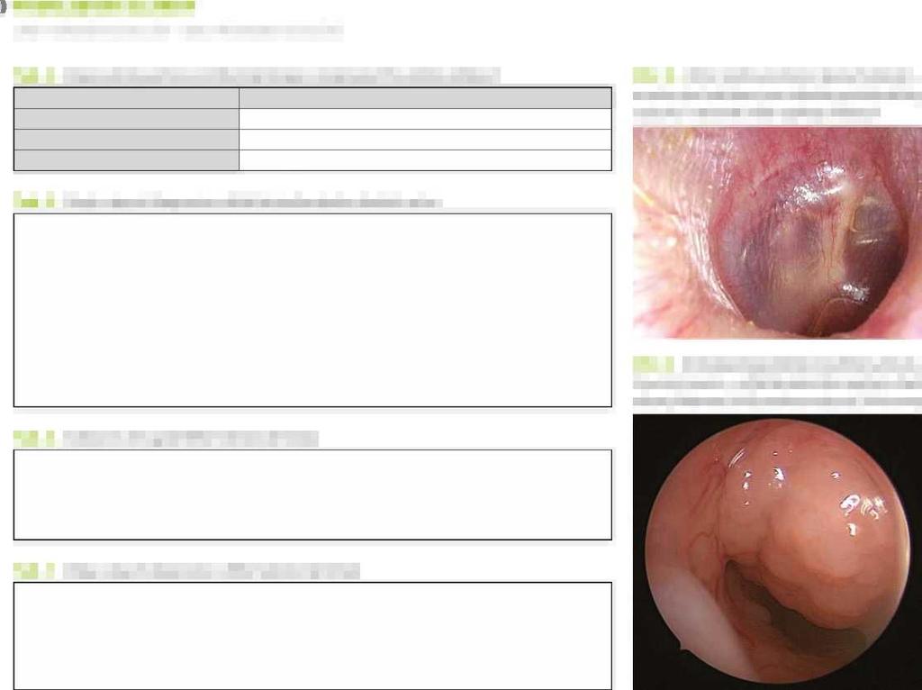 PŘEHLEDOVÉ ČLÁNKY Záněty středního ucha u dětí omyly Při diagnostice a léčbě Tab. 4. Doporučená systémová antibiotické terapie v terapii akutního zánětu středouší SKUPINA ATB ATB 1.