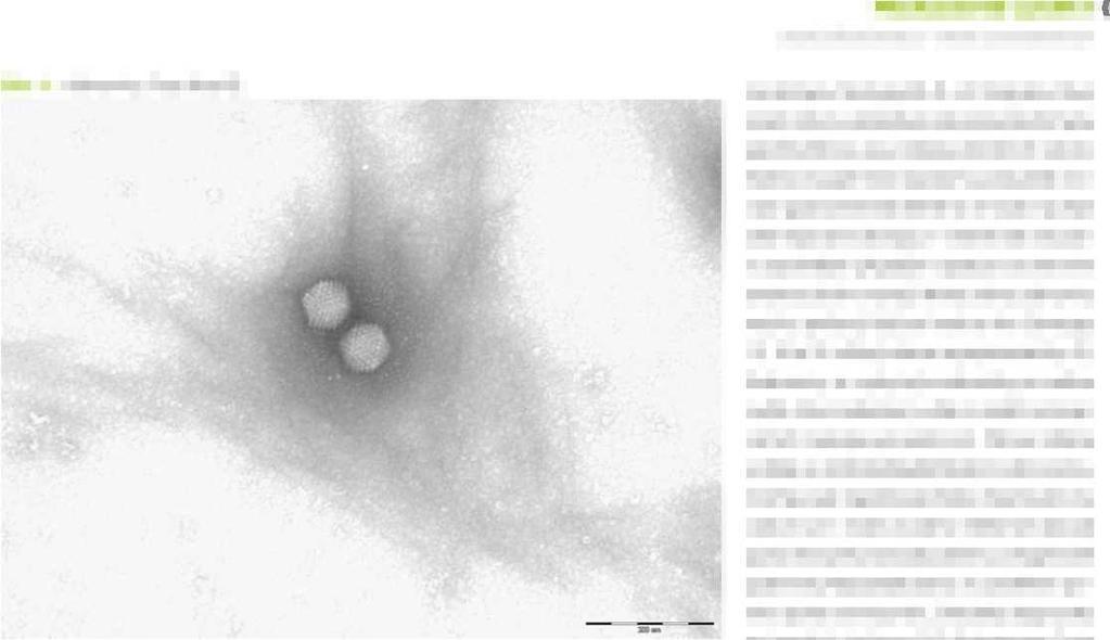 PŘEHLEDOVÉ ČLÁNKY virové střevní infekce virové gastroenteritidy Obr. 1. Adenovirus. Foto: Krsek D. závratěmi a točením hlavy.