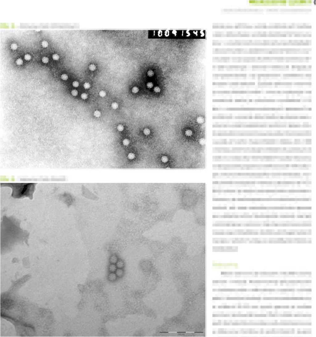 PŘEHLEDOVÉ ČLÁNKY virové střevní infekce virové gastroenteritidy Obr. 4. Astrovirus. Foto: Schramlová J. Obr. 5. Sapovirus. Foto: Krsek D.
