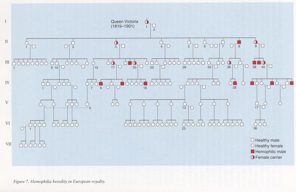 hemofilie (nejznámější rodokmen) - dědi královna