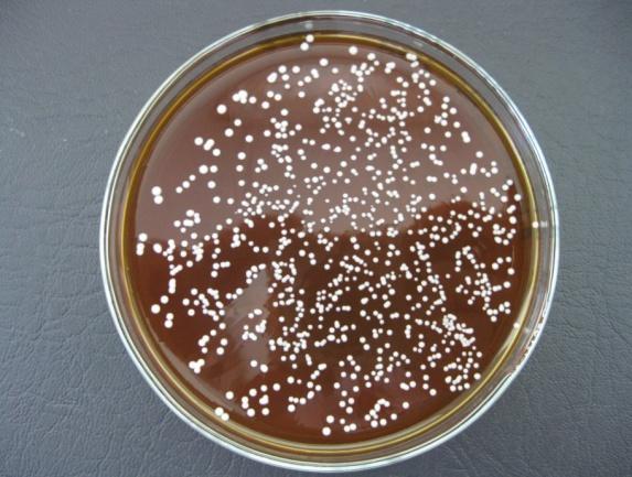 Obr. 9: Výsev bakteriální kultury rodu Bifidobacterium. Tekuté médium se zakalilo. Na miskách narostly kolonie stejného tvaru, bílého, neprůhledného a lesklého vzhledu. 6.