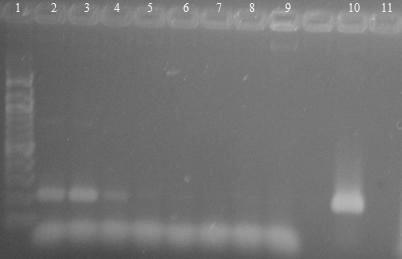 6.3 Rodově specifická PCR pro rod Lactobacillus Byla provedena PCR s purifikovanou DNA izolovanou z čisté bakteriální kultury. DNA z hrubých lyzátů buněk byla izolována metodou fenolové extrakce.