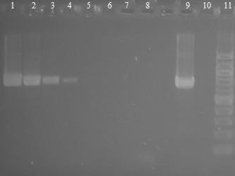 6.3.2 Druhově specifická PCR pro různé druhy Lactobacillus s různým mnoţstvím DNA matrice čisté bakteriální kultury Byla testována druhově specifická PCR pro druhy Lactobacillus acidophilus,