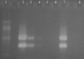 6.3.5 Druhově specifická PCR Lactobacillus plantarum DNA z čisté kultury Lactobacillus plantarum CCM 1904 byla naředěna TE pufrem na koncentraci 10 ng/µl 1 fg/ l a následně amplifikována s druhově