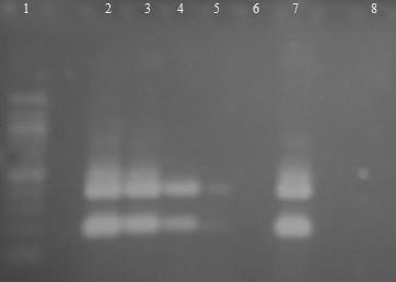 6.3.6 Druhově specifická PCR Lactobacillus casei DNA z čisté kultury Lactobacillus casei CCM 4791 byla naředěna TE pufrem na koncentraci 10 ng/µl 1 fg/ l a následně amplifikována s druhově
