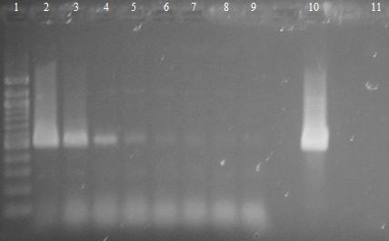 6.4 Rodově specifická PCR pro rod Bifidobacterium Byla provedena PCR s purifikovanou DNA izolovanou z čisté bakteriální kultury. DNA z hrubých lyzátů buněk byla izolována metodou fenolové extrakce.
