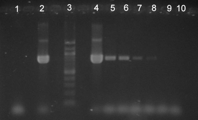 6.4.2 Amplifikace druhově specifické PCR pro různé druhy Bifidobacterium s různým mnoţstvím DNA matrice čisté bakteriální kultury Byla testována druhově specifická PCR pro druhy Bifidobacterium