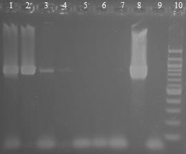 6.4.4 Druhově specifická PCR Bifidobacterium infantis DNA z čisté kultury Bifidobacterium infantis CCM 3764 byla naředěna TE pufrem na koncentraci 100 pg/µl 100 fg/ l a následně amplifikována s