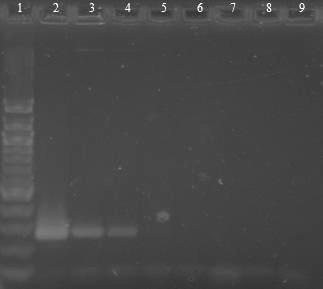 6.4.5 Druhově specifická PCR Bifidobacterium bifidum DNA z čisté kultury Bifidobacterium bifidum CCM 7274 byla naředěna TE pufrem na koncentraci 10 ng/µl 1 fg/ l a následně amplifikována s druhově
