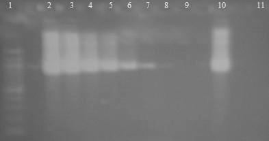 6.5 Druhově specifická PCR pro druh Streptococcus Byla testována druhově specifická PCR pro druh Streptococcus thermophilus. Do PCR byla použíta čistá DNA sbírkových kmenů. 6.5.1 Druhově specifická