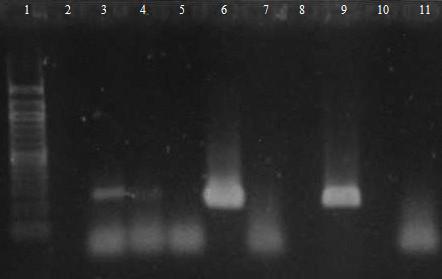 Obr. 21: Agarosová gelová elektroforéza rodově specifických PCR produktů (250 bp) s primery LbLMA-1 a R16-1.