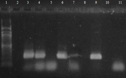 Ověření amplifikovatelnosti DNA bylo provedeno ve specifické PCR pro rod Lactobacillus. Byly použity rodově specifické primery pro bakterie rodu Lactobacillus LBLMA1 a R16-1 (viz. kapitola 5.5.4).
