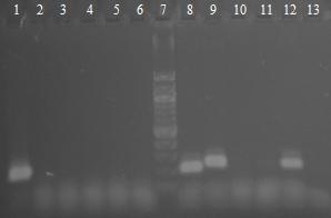 Magnetické částice Fenolová extrakce Magnetické částice Fenolová extrakce Tabulka 31: Množství DNA izolované z tablet metodou fenolové extrakce a magnetickými částicemi (55 C/3 hod) Výrobek Mnoţství