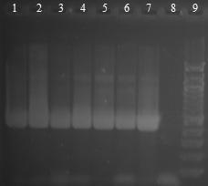 6.14 Ověření amplifikace DNA v doménově specifické PCR s DNA izolovanou z 6 výrobků potravinových doplňků pomocí magnetického nosiče Pro izolaci byl proveden postup popsán v kapitole 6.13.