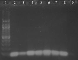 Detekce specifického PCR produktu (500 bp) pro doménu Bacteria byl velmi zřetelný po amplifikaci DNA izolované ze všech testovaných preparátů magnetickými nosiči. 6.