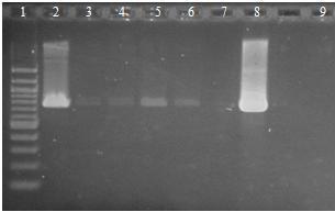 6.16 Druhově specifická PCR Lactobacillus s DNA izolovanou z výrobků potravinových doplňků magnetickými nosiči Probiotické preparáty byly zpracovány dle postupu uvedeného v kapitole 6.8.