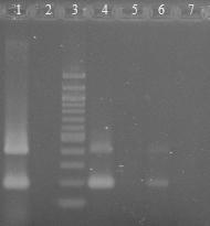 6.16.2 Druhově specifická PCR pro Lactobacillus rhamnosus s primery PrI a PhaII Byly použity druhově specifické primery pro bakterie druhu Lactobacillus rhamnosus PrI a PhaII (viz kapitola 5.5.5).