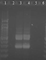 6.16.4 Druhově specifická PCR pro Lactobacillus plantarum s primery PlanI a PlanII Byly použity druhově specifické primery pro bakterie druhu Lactobacillus plantarum PlanI a PlanII (viz kapitola 5.5.5).