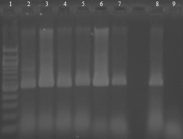 6.17 Rodově specifická PCR Bifidobacterium s DNA izolovanou z výrobků potravinových doplňků magnetickými nosiči Probiotické preparáty byly zpracovány dle postupu uvedeného v kapitole 6.8.