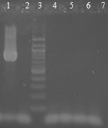 6.18 Druhově specifická PCR Bifidobacterium s DNA izolovanou z výrobků potravinových doplňků magnetickými nosiči Probiotické preparáty byly zpracovány dle postupu uvedeného v kapitole 6.8. Byly voleny a provedeny takové druhově specifické PCR, které byly deklarovány výrobcem tj.