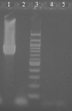 6.18.2 Druhově specifická PCR pro Bifidobacterium infantis s primery BiINF-1 a BiINF2 Byly použity druhově specifické primery pro bakterie druhu Bifidobacterium infantis BiINF-1 a BiINF-2 (viz