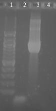 6.18.5 Druhově specifická PCR pro Streptococcus thermophilus s primery S.therm 1 a S.therm 2 Byly použity druhově specifické primery pro bakterie druhu Streptococcus thermophilus S.therm 1 a S.therm2 (viz kapitola 5.