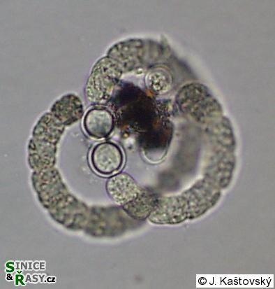 Bakterie s buněčnou stěnou gramnegativního typu akineta Anabaena doliformis heterocyt Kmen