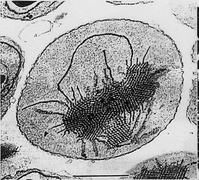 Obr.10-15. Etioplast s prolamelárním tělesem (a) a prothylakoidy (b) u dýně (Cucurbita moschata, var. meloneaformis). b a (Murakami S., Yamada N.