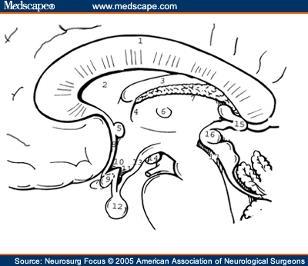 Hypothalamus