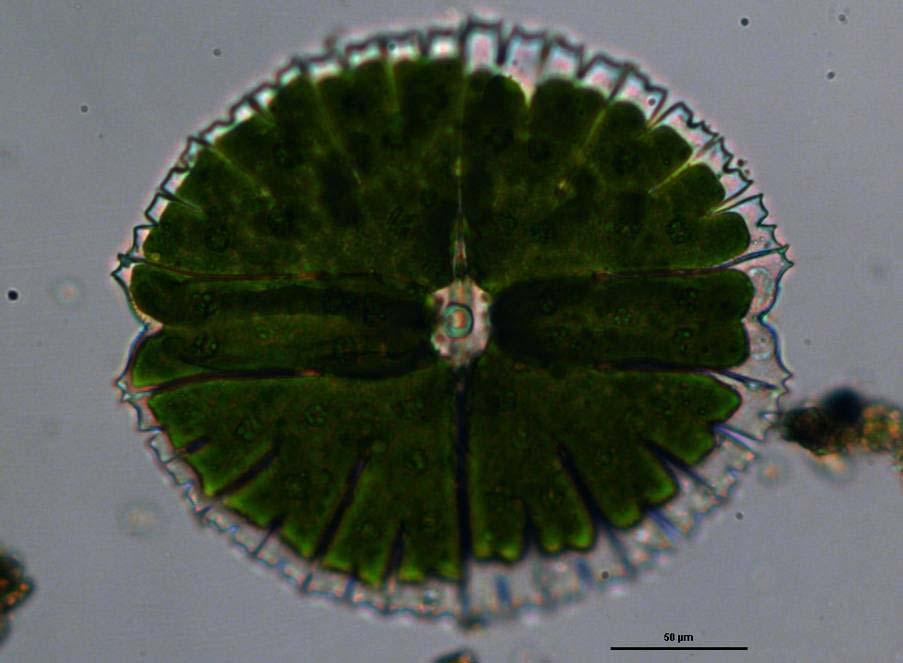 Odd.: Charophyta Trieda: Zygnematophyceae Rad: Desmidiales Micrasterias sp.