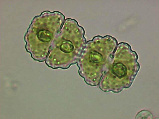 Odd.: Charophyta Trieda: Zygnematophyceae Rad: Desmidiales materská polovica bunky istmus dcérske