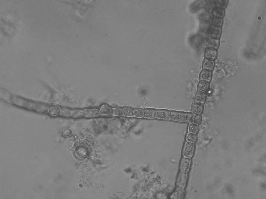 Odd.: Cyanophyta/Cyanobacteria Třída: Cyanophyceae Řád: