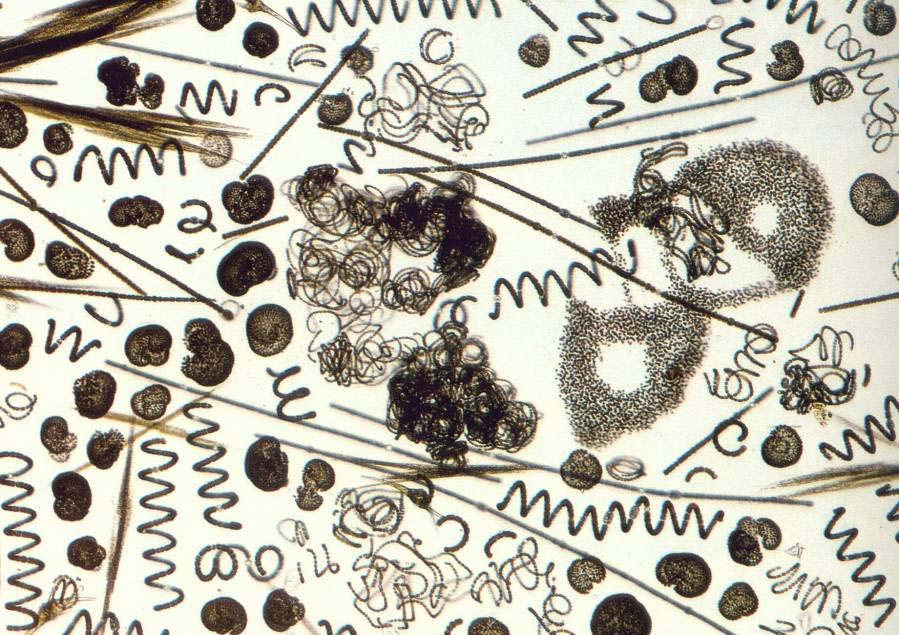 Sinicový vodní květ v mikroskopu Aphanizomenon
